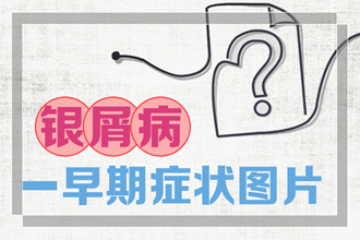 哪些我们不知道的维生素对牛皮癣患者是有帮助的