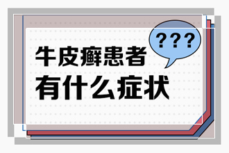 关于一些牛皮癣患者脚治疗的一些优点和缺点大家知道吗